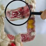 Novos casos de doenças intestinais aumentam no Brasil